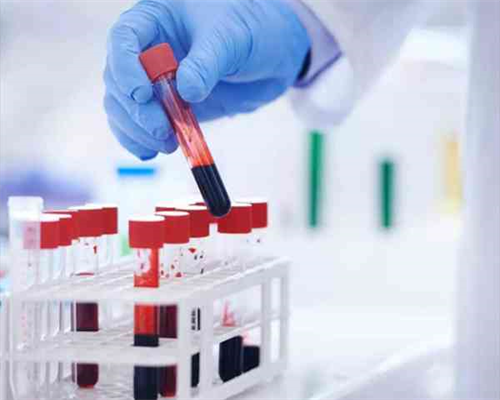 包成功代孕费用多少,「最佳排名榜」卵巢功能不好做试管的成功率如何