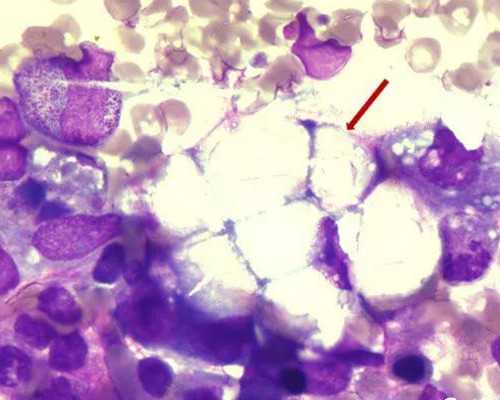 产后3天下身怎么清洗？产后3天可以吃什么菜？