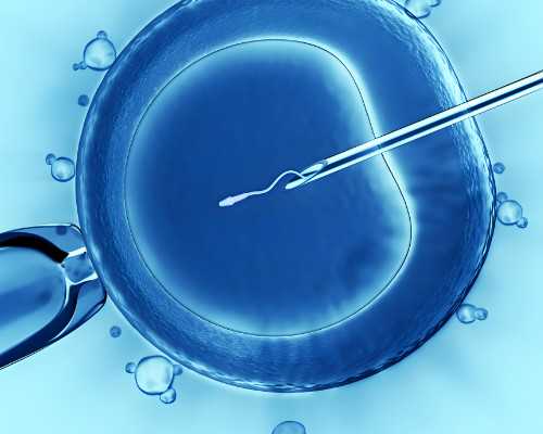 包成功代孕哪家靠谱,为什么会有多囊卵巢（卵巢保养）