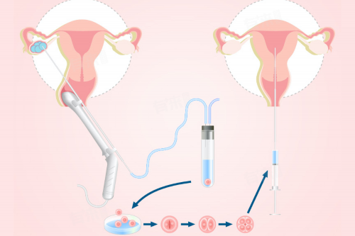 代生费用，雪诺酮为什么不能塞深？雪诺酮塞得太深会影响胚胎吗