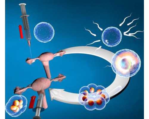 代孕生孩子中心,试管婴儿为什么会出现卵巢过度刺激综合征